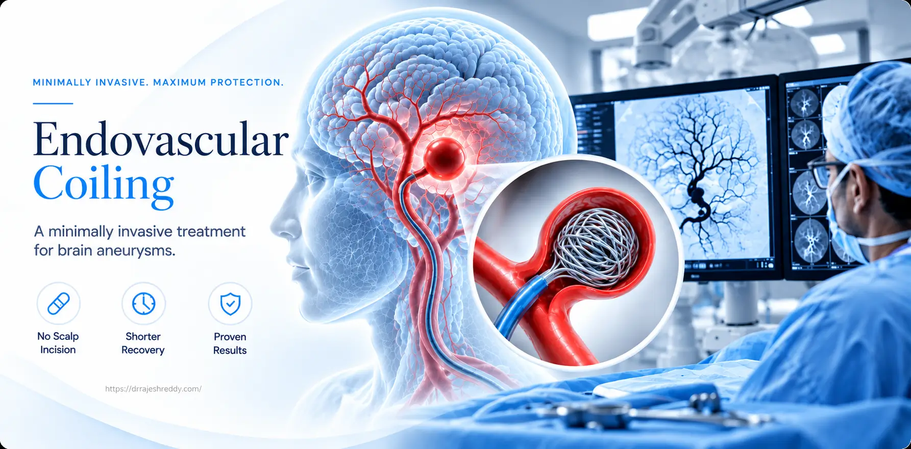 Endovascular Coiling for Brain Aneurysm in Hyderabad